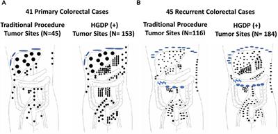 A Concept for Preoperative and Intraoperative Molecular Imaging and Detection for Assessing Extent of Disease of Solid Tumors